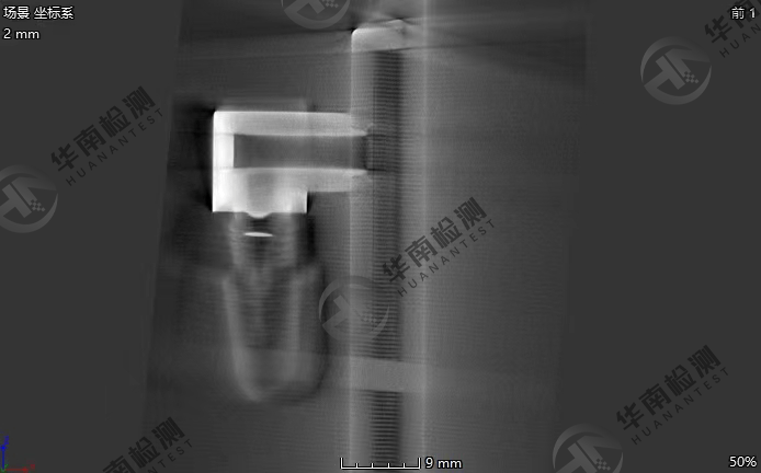 金屬偽影 金屬偽影